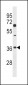 DKK2 Antibody (C-term)